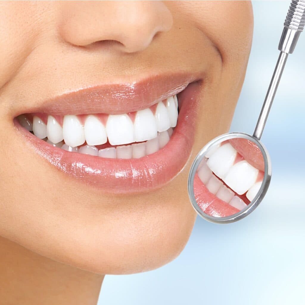 Close-up of a healthy smile with a dental mirror