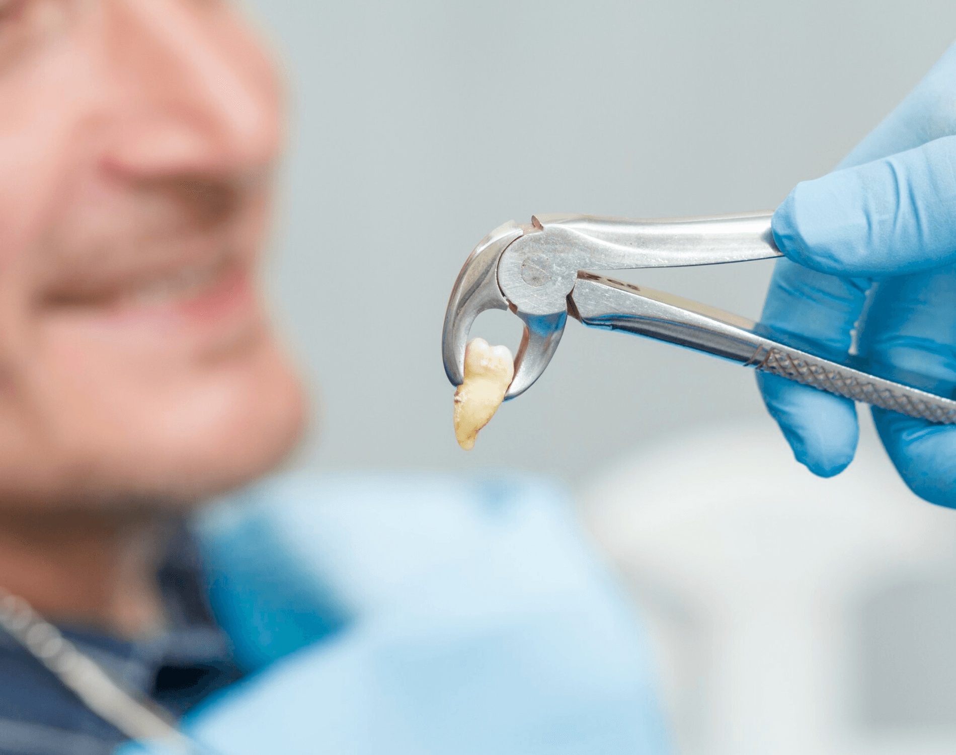 Dentist holding forceps with an extracted tooth